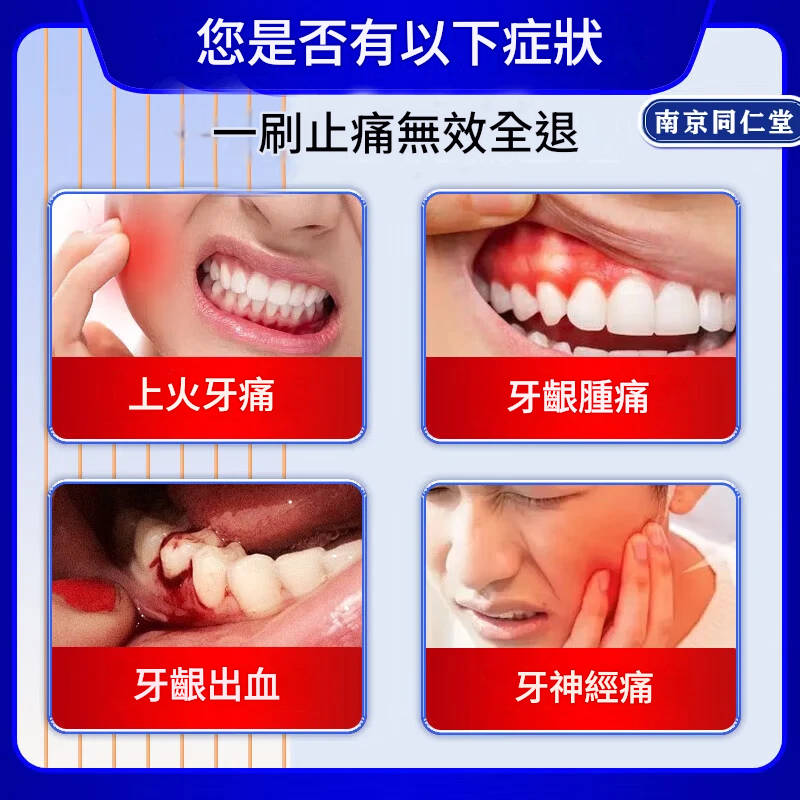 牙痛寧止疼噴霧劑智齒牙齦上火腫痛快速消炎止痛殺牙神經專用藥水 牙痛寧止疼噴霧劑智齒牙齦上火腫痛快速消炎止痛殺牙神經專用藥水